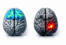 Digital detox brain illustration. Brain scan comparison showing reduced prefrontal cortex activity and increased amygdala reactivity in heavy screen users versus balanced digital use patterns.