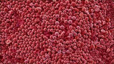 Vitamin deficiency anemia megaloblastic cells versus healthy red blood cells comparison.